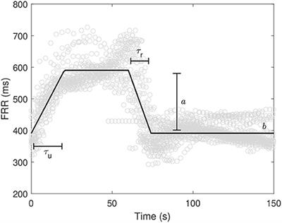 Relationship Between Deceleration Morphology and Phase Rectified Signal Averaging-Based Parameters During Labor